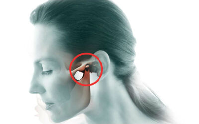Dysfonction cranio-mandibulaire : quand la mâchoire parle au reste du corps
